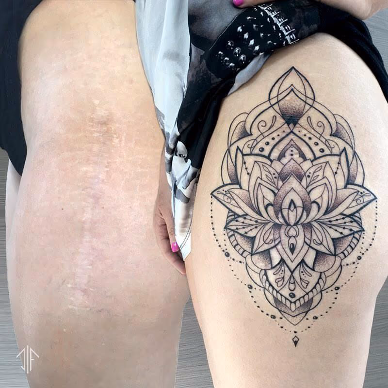 Decorative Thigh Coverup
