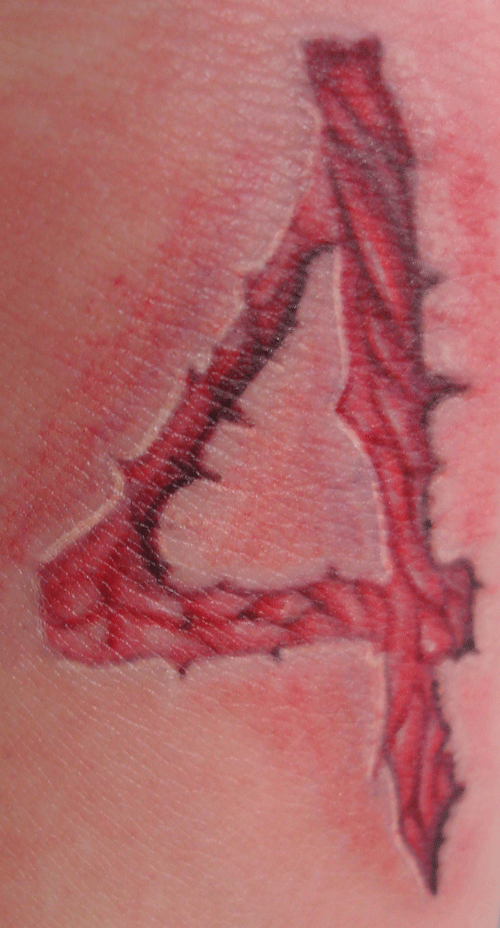 skin cuts