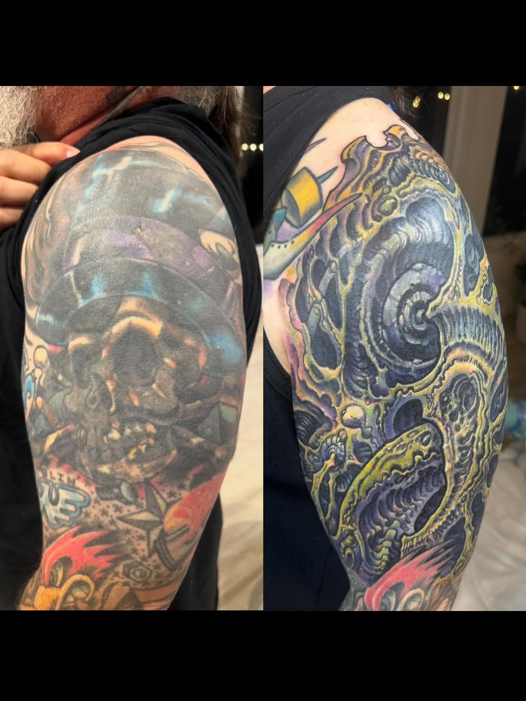 Biomechanical color cover-up sleeve, shoulder