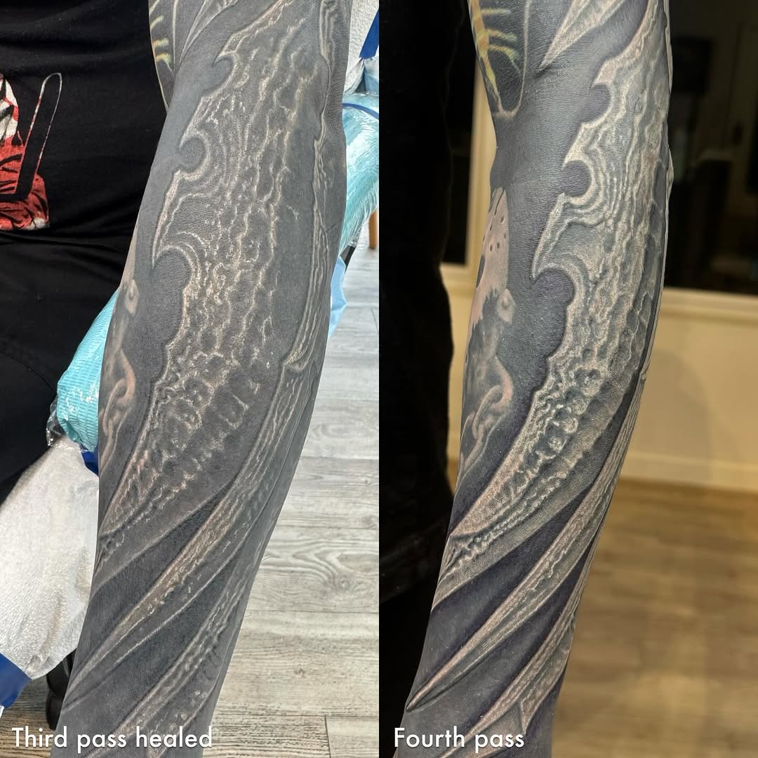 Biomechanical blackout sleeve, healing progress