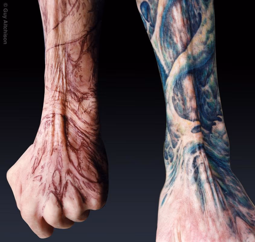 Grime, third degree burn scar coverup
