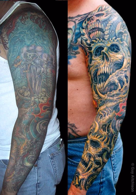 Robert, 3 laser sessions and three passes of tattooing