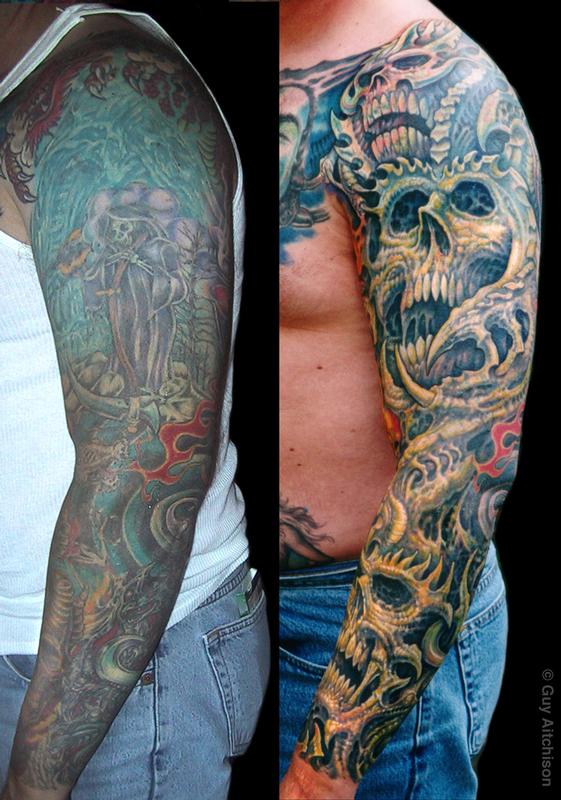 Robert, 3 laser sessions and three passes of tattooing
