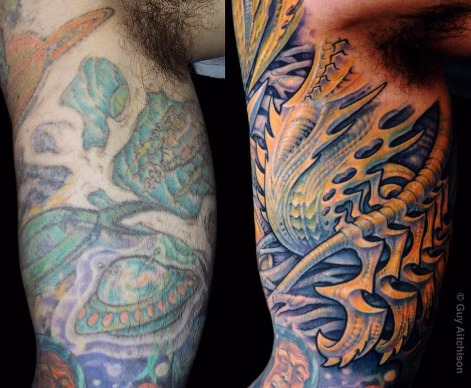David, inner arm, before and after