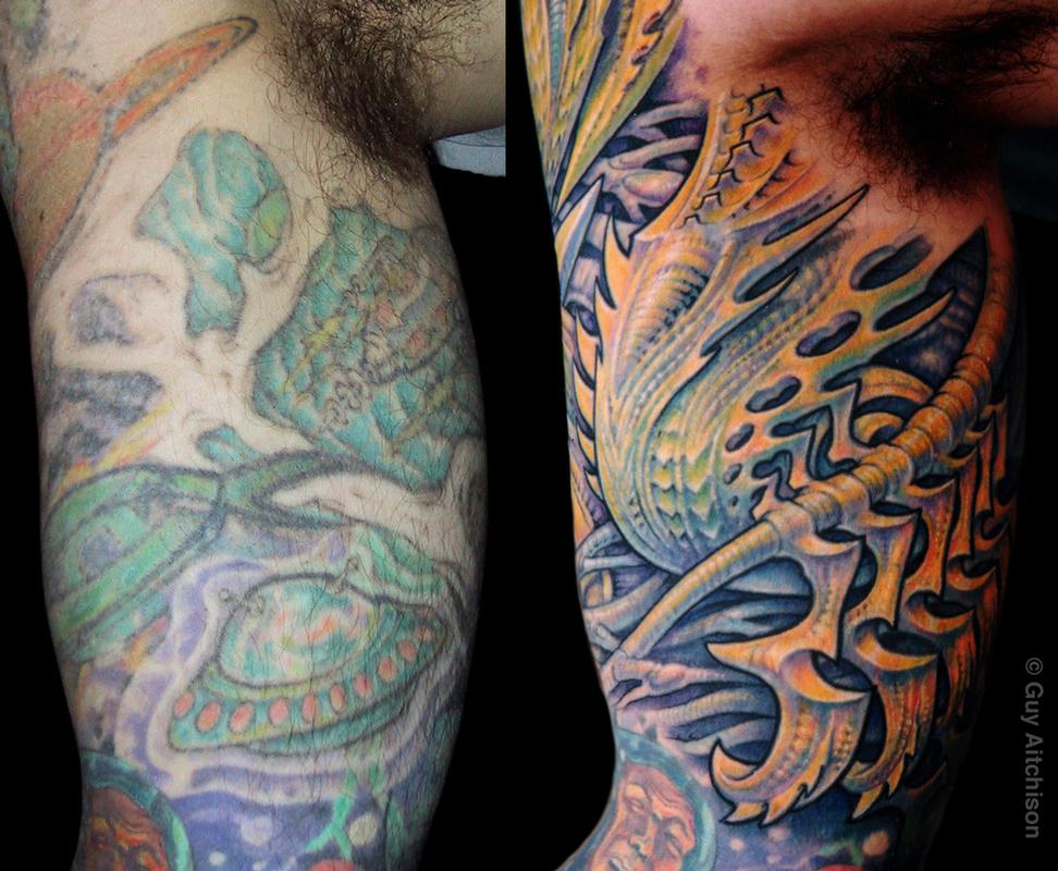 David, inner arm, before and after