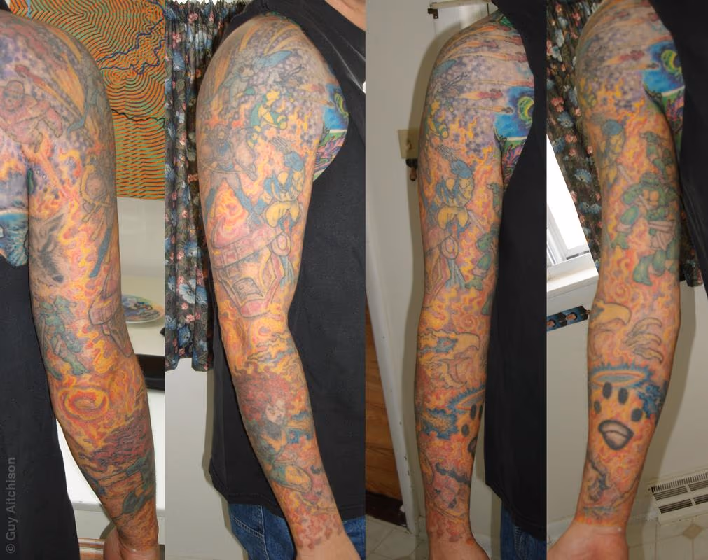 Scott, full sleeve after 4 laser sessions