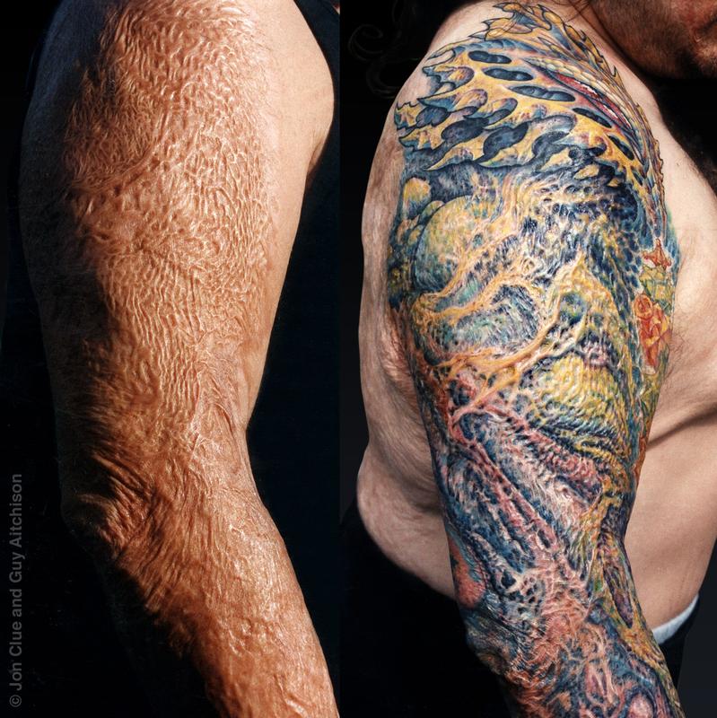 Anthony (burn scar coverup), Collaboration by Jon Clue and Guy Aitchison