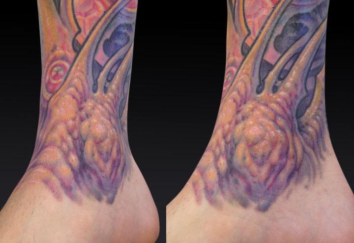 Adam_Ankle