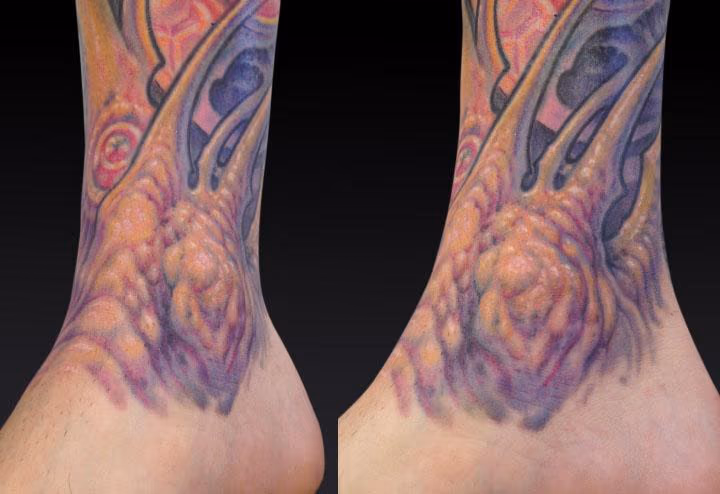 Adam_Ankle