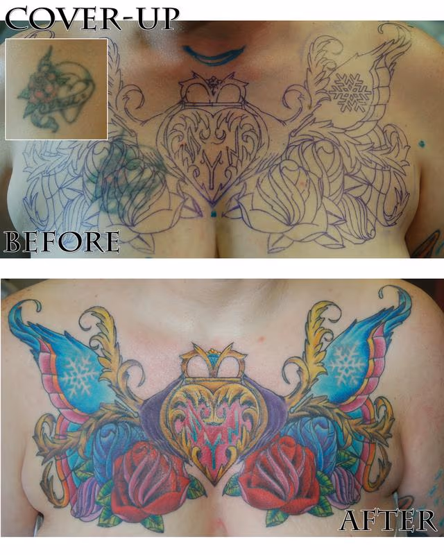 Heart cover-up