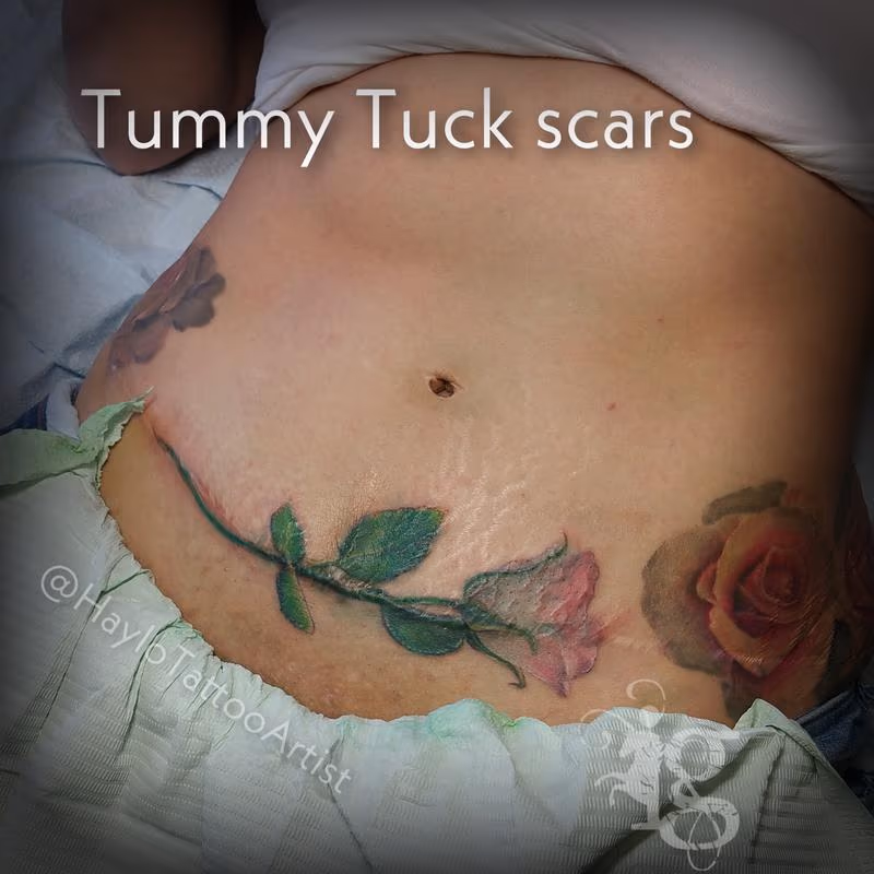 Tummy Tuck TT cover-up tattoo by Haylo - Long Stem Rose