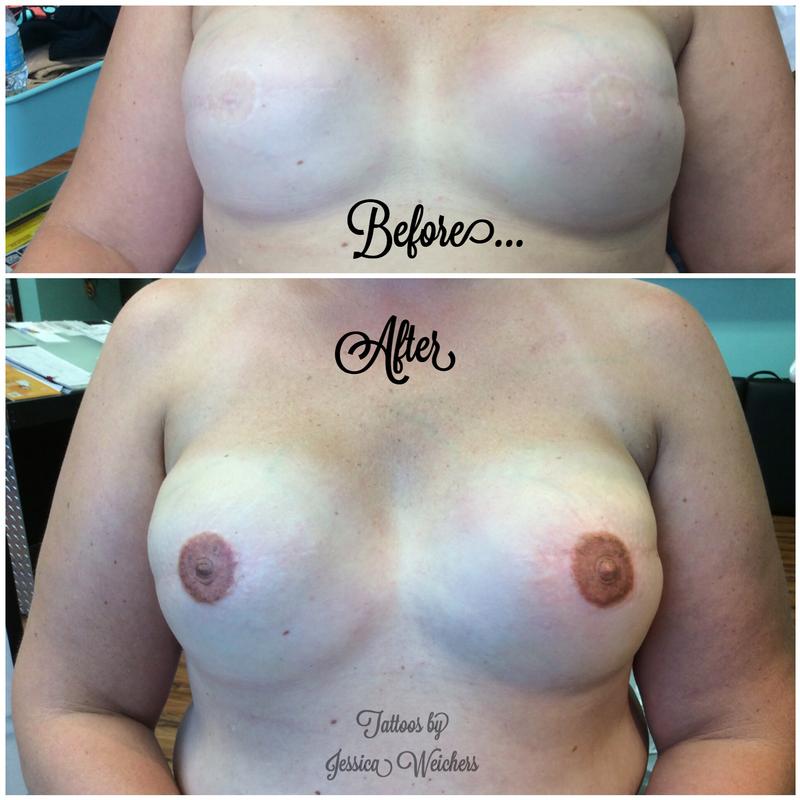 Areola / Nipple Reconstruction Tattoo