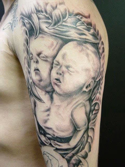 Siamese Twins