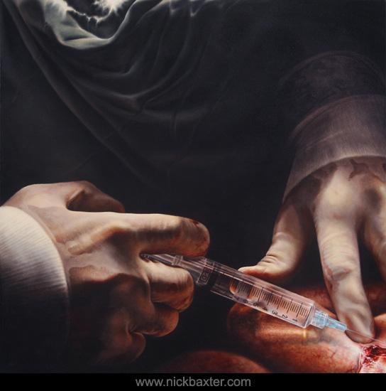 Anointing