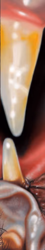 teeth 2