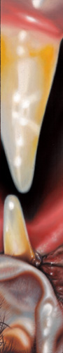teeth 2