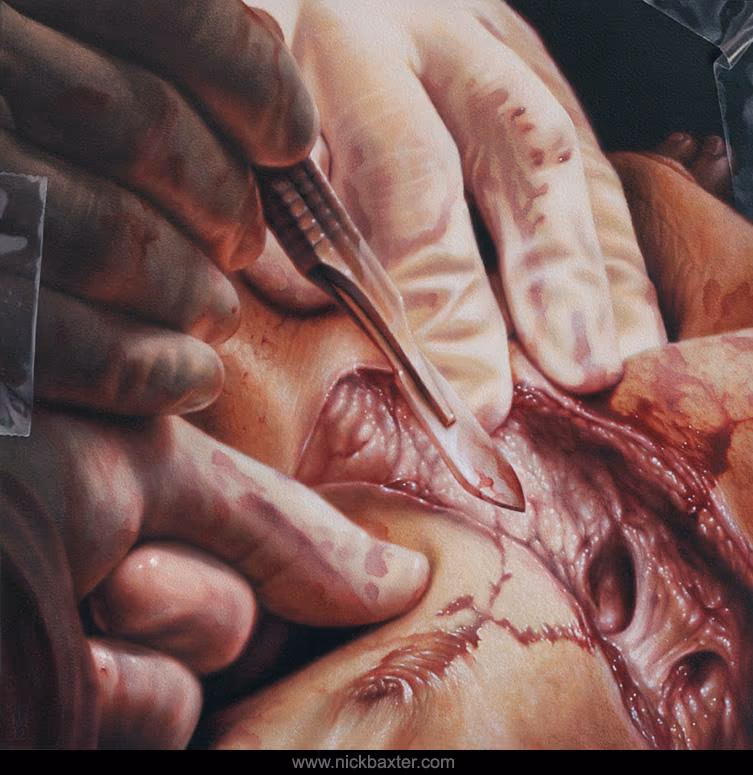 Sacrificial
