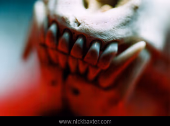 postmortem