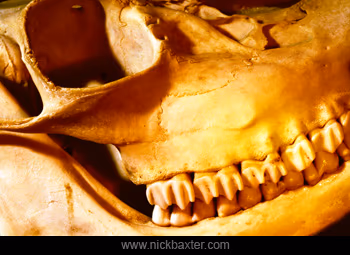 postmortem