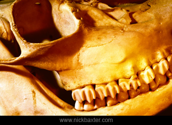 postmortem