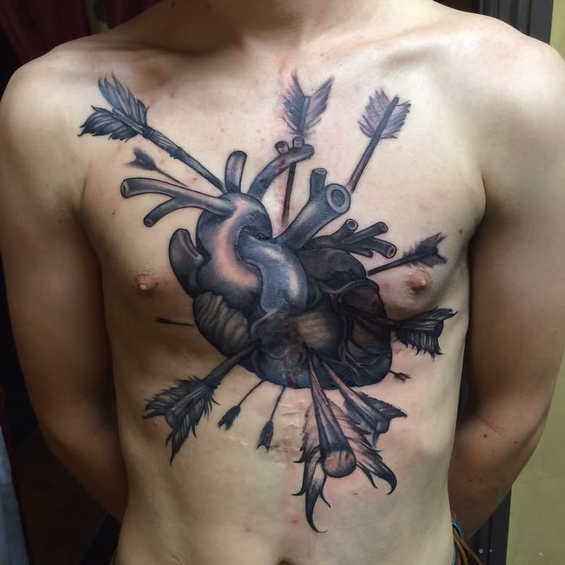Heart transplant surgery