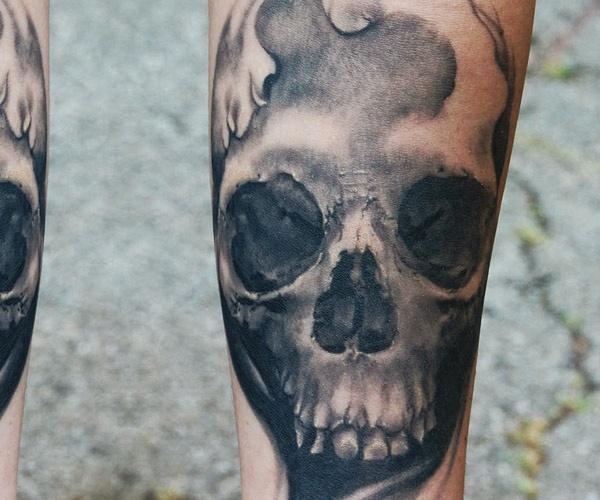 Healed forearm skull