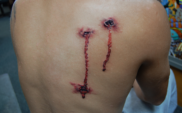Bullet wounds