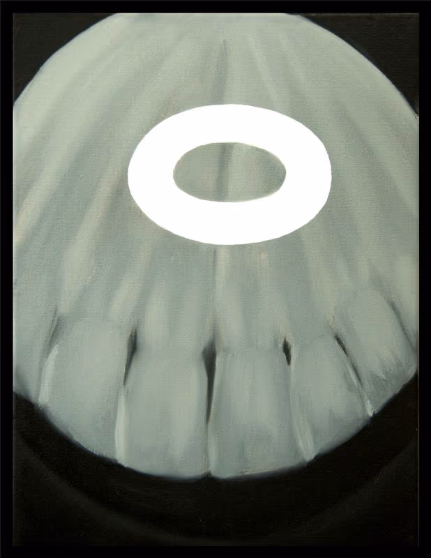 X Ray with Septum ring