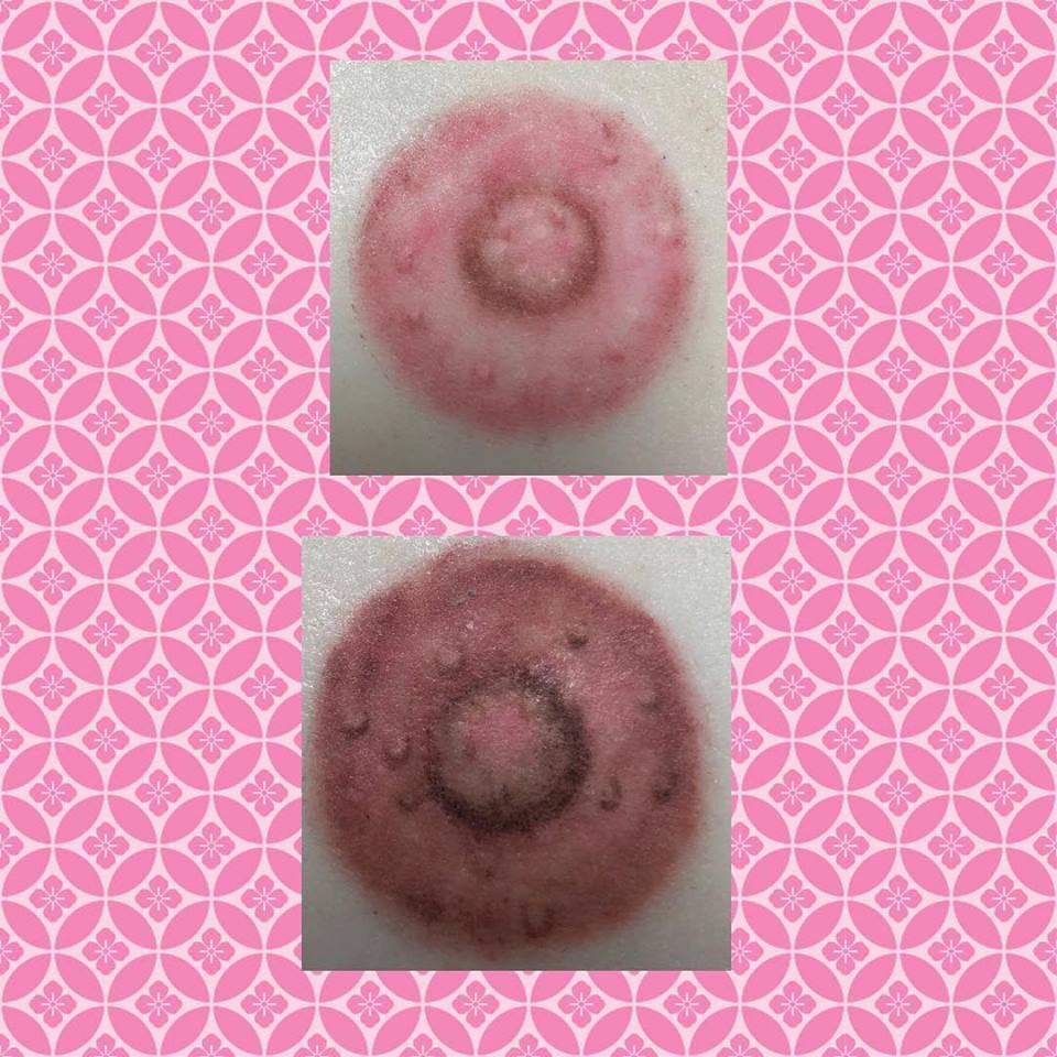 Breast Cancer Reconstruction Tattoo