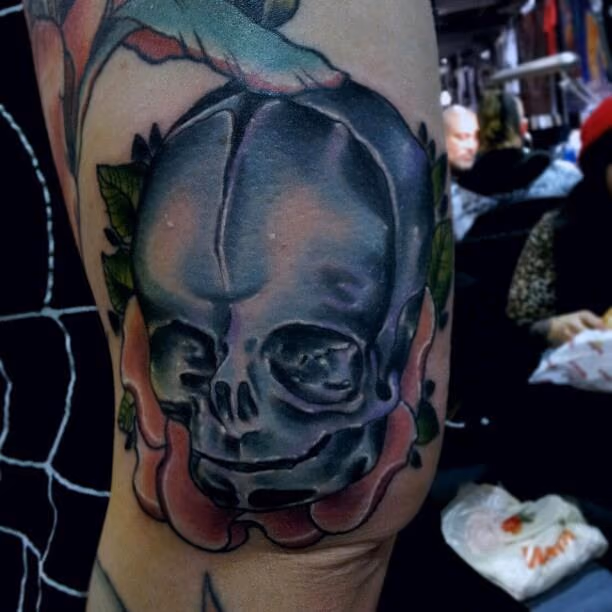 Fetal Skull