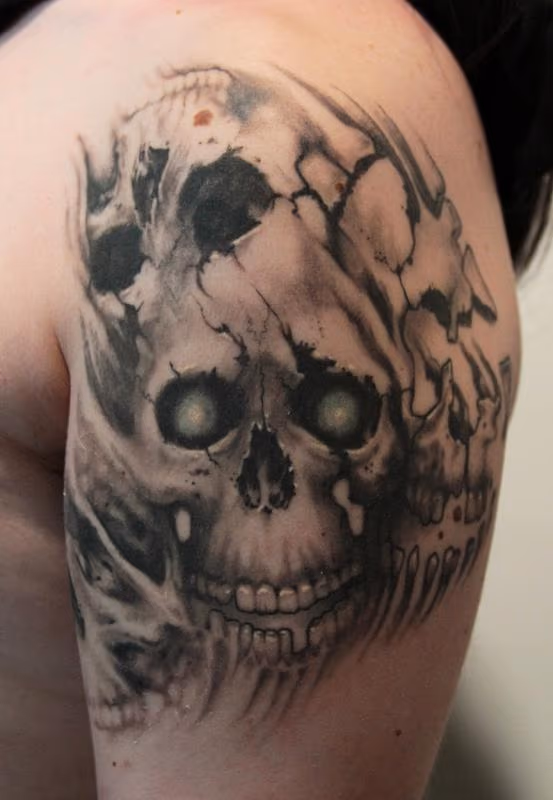 Healed Skull Mix Up