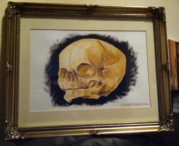 Fetal skull