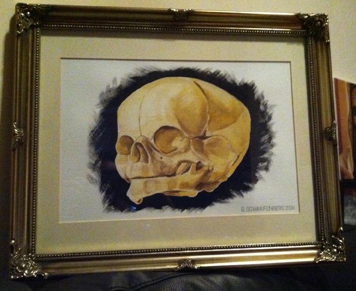 Fetal skull