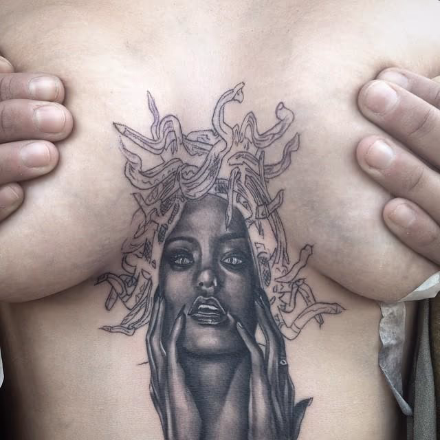 Medusa