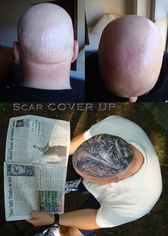 Freddy had very bad scars all over his head so we covered them with JESUS