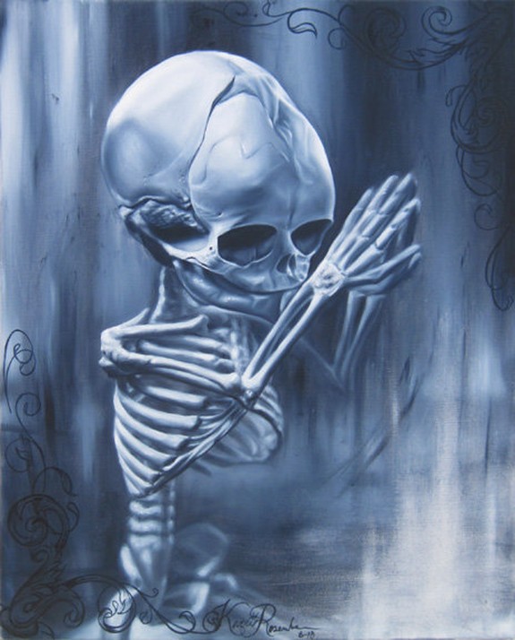 Fetal skeleton
