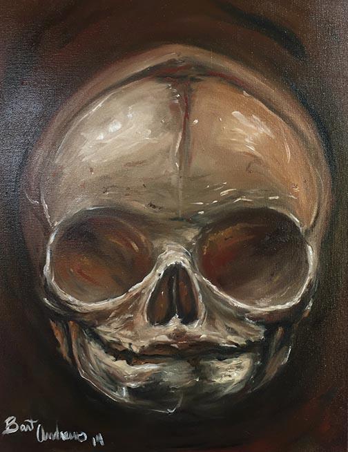 Fetal Skull