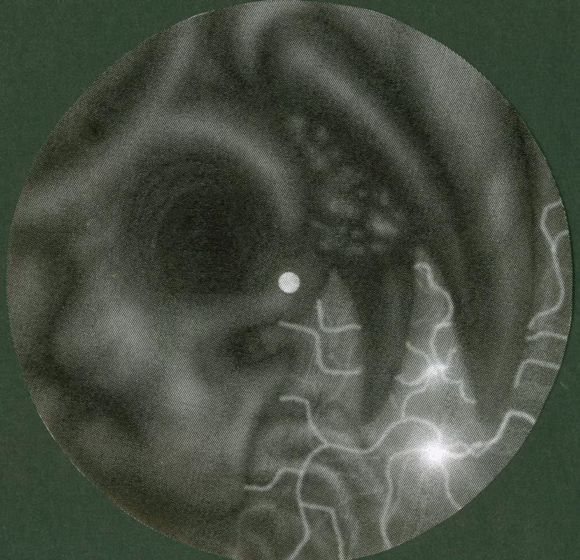 skull moon
